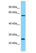 IDH3B Antibody - IDH3B antibody Western Blot of HepG2. Antibody dilution: 1 ug/ml.  This image was taken for the unconjugated form of this product. Other forms have not been tested.