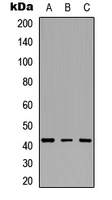 IDH3B Antibody - Western blot analysis of IDH3 beta expression in HeLa (A); Jurkat (B); PC12 (C) whole cell lysates.