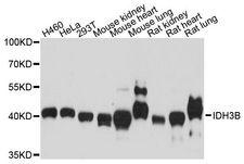 IDH3B Antibody - Western blot analysis of extracts of various cell lines, using IDH3B antibody at 1:3000 dilution. The secondary antibody used was an HRP Goat Anti-Rabbit IgG (H+L) at 1:10000 dilution. Lysates were loaded 25ug per lane and 3% nonfat dry milk in TBST was used for blocking. An ECL Kit was used for detection and the exposure time was 60s.