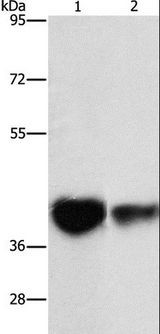 IDH3G Antibody - Western blot analysis of Mouse brain tissue and NIH/3T3 cell, using IDH3G Polyclonal Antibody at dilution of 1:350.