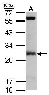 IDI1 / IPP1 Antibody - Sample (30 ug of whole cell lysate). A: Molt-4 . 12% SDS PAGE. IDI1 / IPP1 antibody diluted at 1:3000.