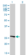 IDI1 / IPP1 Antibody - Western Blot analysis of IDI1 expression in transfected 293T cell line by IDI1 monoclonal antibody (M01), clone 6G10.Lane 1: IDI1 transfected lysate(26.5 KDa).Lane 2: Non-transfected lysate.