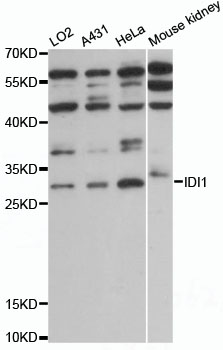 IDI1 / IPP1 Antibody - Western blot analysis of extracts of various cell lines, using IDI1 antibody at 1:1000 dilution. The secondary antibody used was an HRP Goat Anti-Rabbit IgG (H+L) at 1:10000 dilution. Lysates were loaded 25ug per lane and 3% nonfat dry milk in TBST was used for blocking. An ECL Kit was used for detection and the exposure time was 10s.