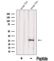 IDI1 / IPP1 Antibody - Western blot analysis of extracts of mouse liver tissue using IDI1 antibody. The lane on the left was treated with blocking peptide.
