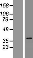 IDI2 Protein - Western validation with an anti-DDK antibody * L: Control HEK293 lysate R: Over-expression lysate