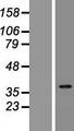 IDI2 Protein - Western validation with an anti-DDK antibody * L: Control HEK293 lysate R: Over-expression lysate