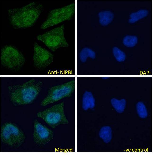 IDN3 / NIPBL Antibody - NIPBL (aa889-902) Antibody Immunofluorescence analysis of paraformaldehyde fixed HeLa cells, permeabilized with 0.15% Triton. Primary incubation 1hr (10ug/ml) followed by Alexa Fluor 488 secondary antibody (4ug/ml), showing nuclear and cytoplasmic staining. The nuclear stain is DAPI (blue). Negative control: Unimmunized goat IgG (10ug/ml) followed by Alexa Fluor 488 secondary antibody (4ug/ml).