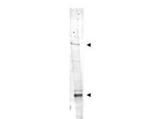 IDN3 / NIPBL Antibody - Anti-IDN3 Antibody - Western Blot. Western blot of Affinity Purified anti-IDN3 antibody shows detection of bands at ~315 kD and ~125 kD corresponding to isoforms of IDN3 (arrow-heads) in mouse heart whole cell tissue extract. Approximately 35 ug of lysate was separated on a 4-8% gel by SDS-PAGE and transferred onto nitrocellulose. After blocking the membrane was probed with the primary antibody diluted to 1:1500. Reaction occurred overnight at 4? followed by washes and reaction with a 1:20000 dilution of IRDye800 conjugated Rb-a-Goat IgG [H&L] MXHu ( for 45 min at room temperature. IRDye800 fluorescence image was captured using the Odyssey Infrared Imaging System developed by LI-COR. IRDye is a trademark of LI-COR, Inc. Other detection systems will yield similar results.