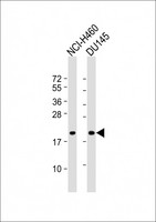 IDNK Antibody - All lanes: Anti-IDNK Antibody (N-Term) at 1:8000 dilution. Lane 1: NCI-H460 whole cell lysate. Lane 2: DU145 whole cell lysate Lysates/proteins at 20 ug per lane. Secondary Goat Anti-Rabbit IgG, (H+L), Peroxidase conjugated at 1:10000 dilution. Predicted band size: 21 kDa. Blocking/Dilution buffer: 5% NFDM/TBST.
