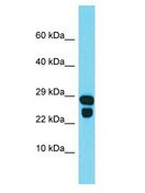 IDNK Antibody - IDNK antibody Western Blot of MCF7. Antibody dilution: 1 ug/ml.  This image was taken for the unconjugated form of this product. Other forms have not been tested.