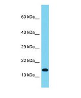 IDNK Antibody - Western blot of IDNK Antibody - N-terminal region with human OVCAR-3 cells lysate.  This image was taken for the unconjugated form of this product. Other forms have not been tested.