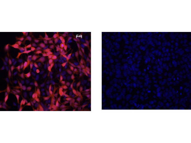 IDO1 / IDO Antibody - Immunofluorescence Microscopy of Mouse anti-IDO1 Antibody. Cells: HEK293 cells. Fixation: 0.5% PFA. Expressing: mouse IDO-1 (left) and mouse IDO-2 (right). Primary antibody: IDO1 (2E2) monoclonal antibody. Antigen retrieval: not required. Secondary antibody: mouse secondary antibody at 1:10,000 for 45 min at RT. Localization: IDO-1 is located in the cytosol. Staining: IDO1 as red fluorescent signal with bis-benzimide nuclear counterstain (blue).