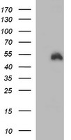 IDO1 / IDO Antibody - HEK293T cells were transfected with the pCMV6-ENTRY control (Left lane) or pCMV6-ENTRY IDO1 (Right lane) cDNA for 48 hrs and lysed. Equivalent amounts of cell lysates (5 ug per lane) were separated by SDS-PAGE and immunoblotted with anti-IDO1.