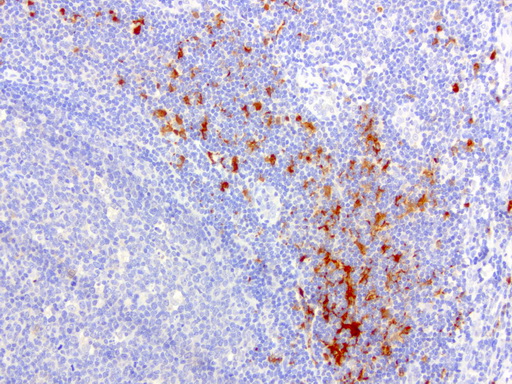 IDO1 / IDO Antibody - Immunohistochemical staining of paraffin-embedded human tonsil using anti-IDO1 clone UMAB126 mouse monoclonal antibody at 1:200 dilution of 1.0 mg/mL using Polink2 Broad HRP DAB for detection.requires HIER with with citrate pH6.0 at 110C for 3 min using pressure chamber/cooker. The tonsil shows strong membrane and cytoplasmic in the germinal center and rare strong nuclear, membrane, and cytoplasmic staining in the non germinal centers.