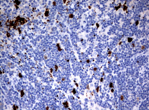 IDO1 / IDO Antibody - Immunohistochemical staining of paraffin-embedded Human lymph node tissue using anti-IDO1 mouse monoclonal antibody.  heat-induced epitope retrieval by 10mM citric buffer, pH6.0, 120C for 3min)