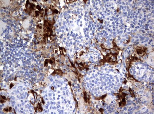 IDO1 / IDO Antibody - Immunohistochemical staining of paraffin-embedded Human tonsil using anti-IDO1 mouse monoclonal antibody.  heat-induced epitope retrieval by 10mM citric buffer, pH6.0, 120C for 3min)