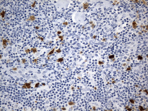 IDO1 / IDO Antibody - Immunohistochemical staining of paraffin-embedded Human lymph node tissue within the normal limits using anti-IDO1 mouse monoclonal antibody. (Heat-induced epitope retrieval by 1mM EDTA in 10mM Tris buffer. (pH8.0) at 120°C for 2.5 min. (1:600)