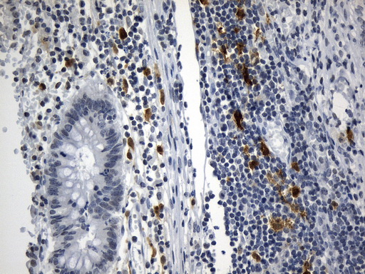 IDO1 / IDO Antibody - Immunohistochemical staining of paraffin-embedded Human appendix tissue within the normal limits using anti-IDO1 mouse monoclonal antibody. (Heat-induced epitope retrieval by 1mM EDTA in 10mM Tris buffer. (pH8.0) at 120°C for 2.5 min. (1:600)