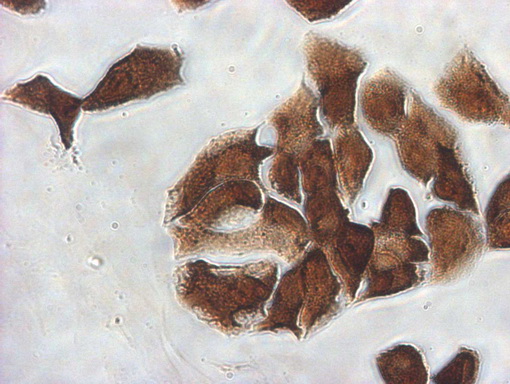 IDO1 / IDO Antibody - Immunocytochemistry staining of H2228 cells using anti-IDO1 mouse monoclonal antibody. (1:100)