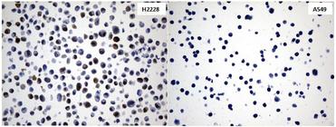 IDO1 / IDO Antibody - Immunohistochemical staining of paraffin-embedded cell pellets(The left is H2228 and the right is A549) using anti-IDO1 Mouse monoclonal antibody. (Heat-induced epitope retrieval by 1mM EDTA in 10mM Tris buffer. (pH8.0) at 120°C for 2.5 min. (1:600)