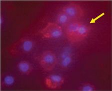 IDO1 / IDO Antibody - Immunocytochemistry fluorescent staining of human mature dendritic cells using anti-IDO (human), pAb .