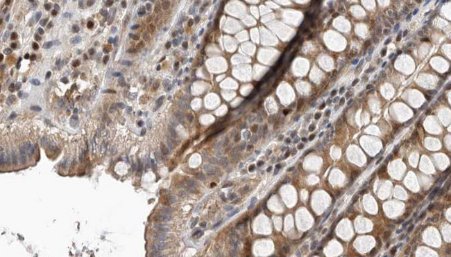 IDO1 / IDO Antibody - 1:100 staining rat colon tissue by IHC-P. The sample was formaldehyde fixed and a heat mediated antigen retrieval step in citrate buffer was performed. The sample was then blocked and incubated with the antibody for 1.5 hours at 22°C. An HRP conjugated goat anti-rabbit antibody was used as the secondary.