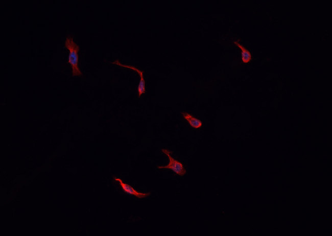 IDO1 / IDO Antibody - Staining HepG2 cells by IF/ICC. The samples were fixed with PFA and permeabilized in 0.1% Triton X-100, then blocked in 10% serum for 45 min at 25°C. The primary antibody was diluted at 1:200 and incubated with the sample for 1 hour at 37°C. An Alexa Fluor 594 conjugated goat anti-rabbit IgG (H+L) antibody, diluted at 1/600, was used as secondary antibody.