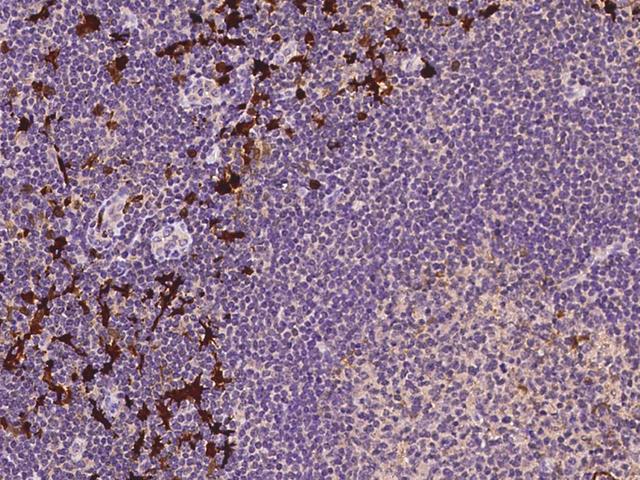IDO1 / IDO Antibody - Immunochemical staining of human IDO1 in human lymph node with rabbit polyclonal antibody at 1:1000 dilution, formalin-fixed paraffin embedded sections.
