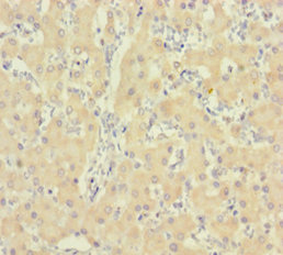 IDO2 / INDOL1 Antibody - Immunohistochemistry of paraffin-embedded human liver tissue using IDO2 Antibody at dilution of 1:100