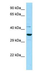 IDO2 / INDOL1 Antibody - IDO2 antibody Western Blot of OVCAR-3.  This image was taken for the unconjugated form of this product. Other forms have not been tested.