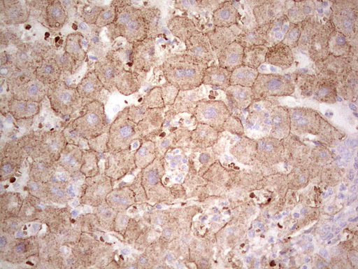 IDO2 / INDOL1 Antibody - Immunohistochemical staining of paraffin-embedded Human liver tissue within the normal limits using anti-IDO2 mouse monoclonal antibody. (Heat-induced epitope retrieval by 1 mM EDTA in 10mM Tris, pH8.5, 120C for 3min,