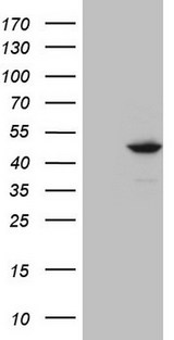 IDO2 / INDOL1 Antibody - HEK293T cells were transfected with the pCMV6-ENTRY control (Left lane) or pCMV6-ENTRY IDO2 (Right lane) cDNA for 48 hrs and lysed. Equivalent amounts of cell lysates (5 ug per lane) were separated by SDS-PAGE and immunoblotted with anti-IDO2.