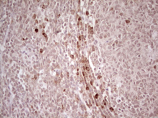 IDO2 / INDOL1 Antibody - Immunohistochemical staining of paraffin-embedded Human tonsil within the normal limits using anti-IDO2 mouse monoclonal antibody. (Heat-induced epitope retrieval by 1 mM EDTA in 10mM Tris, pH8.5, 120C for 3min,