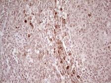 IDO2 / INDOL1 Antibody - IHC of paraffin-embedded Human tonsil using anti-IDO2 mouse monoclonal antibody. (Heat-induced epitope retrieval by 1 mM EDTA in 10mM Tris, pH8.5, 120°C for 3min).