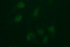 IDO2 / INDOL1 Antibody - Immunofluorescent staining of HeLa cells using anti-IDO2 mouse monoclonal antibody.