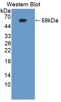 IDS / Iduronate 2 Sulfatase Antibody - Western blot of IDS antibody.
