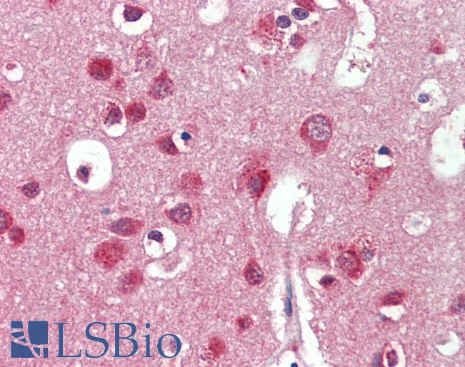 IDS / Iduronate 2 Sulfatase Antibody - Anti-IDS antibody IHC staining of human brain, cortex. Immunohistochemistry of formalin-fixed, paraffin-embedded tissue after heat-induced antigen retrieval. Antibody concentration 10 ug/ml.  This image was taken for the unconjugated form of this product. Other forms have not been tested.