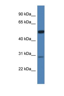 IDS / Iduronate 2 Sulfatase Antibody - IDS antibody Western blot of HeLa Cell lysate. Antibody concentration 1 ug/ml.  This image was taken for the unconjugated form of this product. Other forms have not been tested.