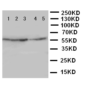 IDS / Iduronate 2 Sulfatase Antibody - WB of IDS antibody. Lane 1: HELA Cell Lysate. Lane 2: SMMC Cell Lysate. Lane 3: A549 Cell Lysate. Lane 4: MCF-7 Cell Lysate. Lane 5: COLO Cell Lysate.