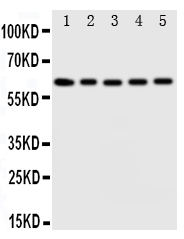 IDS / Iduronate 2 Sulfatase Antibody - Anti-Iduronate 2 sulfatase antibody, Western blotting Lane 1: HELA Cell LysateLane 2: SMMC Cell LysateLane 3: A549 Cell LysateLane 4: MCF-7 Cell LysateLane 5: COLO Cell Lysate