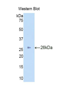 IDS / Iduronate 2 Sulfatase Antibody - Western blot of recombinant IDS.  This image was taken for the unconjugated form of this product. Other forms have not been tested.