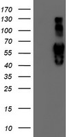 IDS / Iduronate 2 Sulfatase Antibody - HEK293T cells were transfected with the pCMV6-ENTRY control (Left lane) or pCMV6-ENTRY IDS (Right lane) cDNA for 48 hrs and lysed. Equivalent amounts of cell lysates (5 ug per lane) were separated by SDS-PAGE and immunoblotted with anti-IDS.