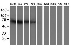 IDS / Iduronate 2 Sulfatase Antibody - Western blot of extracts (35 ug) from 9 different cell lines by using anti-IDS monoclonal antibody.