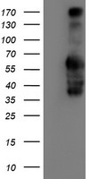 IDS / Iduronate 2 Sulfatase Antibody - HEK293T cells were transfected with the pCMV6-ENTRY control (Left lane) or pCMV6-ENTRY IDS (Right lane) cDNA for 48 hrs and lysed. Equivalent amounts of cell lysates (5 ug per lane) were separated by SDS-PAGE and immunoblotted with anti-IDS.