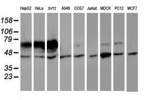 IDS / Iduronate 2 Sulfatase Antibody - Western blot of extracts (35 ug) from 9 different cell lines by using anti-IDS monoclonal antibody.