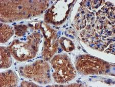 IDS / Iduronate 2 Sulfatase Antibody - IHC of paraffin-embedded Human Kidney tissue using anti-IDS mouse monoclonal antibody.