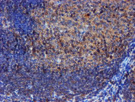 IDS / Iduronate 2 Sulfatase Antibody - IHC of paraffin-embedded Human tonsil using anti-IDS mouse monoclonal antibody.