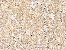 IDS / Iduronate 2 Sulfatase Antibody - Immunohistochemistry of paraffin-embedded Human brain tissue  using IDS Polyclonal Antibody at dilution of 1:70(×200)