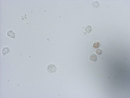IdU / Iododeoxyuridine Antibody - Immunocytochemistry staining of HT-29 cells pulsed with 5-iodo-2'-deoxyuridine (IdU)using mouse monoclonal anti-IDU antibody (1:150).
