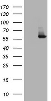 IdU / Iododeoxyuridine Antibody - HEK293T cells were transfected with the pCMV6-ENTRY control (Left lane) or pCMV6-ENTRY PKM1 (Right lane) cDNA for 48 hrs and lysed. Equivalent amounts of cell lysates (5 ug per lane) were separated by SDS-PAGE and immunoblotted with anti-PKM1.